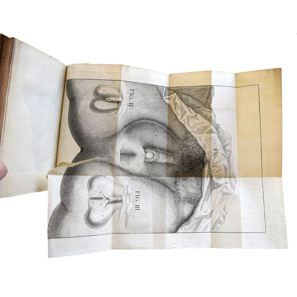 A Mechanical and Critical Enquiry into the Nature of Hermaphrodites